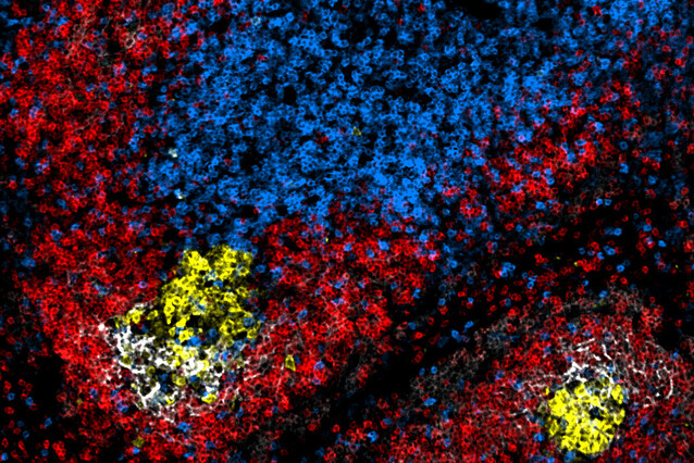 Confocal immunofluorescence microscopy image of a spleen section of a mutant mouse that does not express Bhlhe40. Germinal Centres are shown in yellow and white, CD4 T cells in blue, and Immunoglobulin D in red. Credit: Annika Reinhardt. The image is dotted with red-coloured cells, with two yellow and white spots. The centre-top area is blue, also dotted.