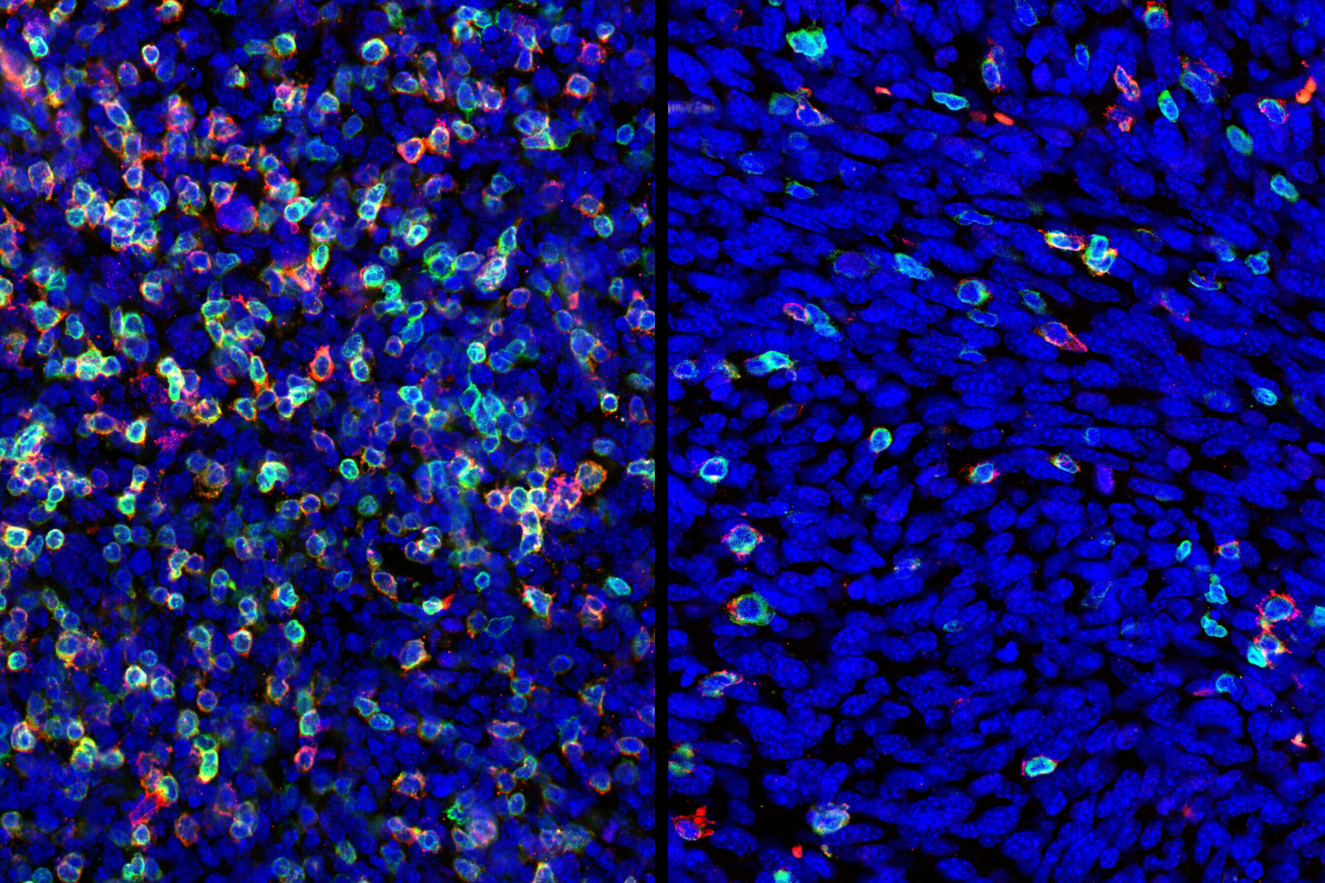 Two panels, on the left a constellation of fluorescent spots within a blue background; on the right much fewer fuorescent spots in a sea of blue spots.