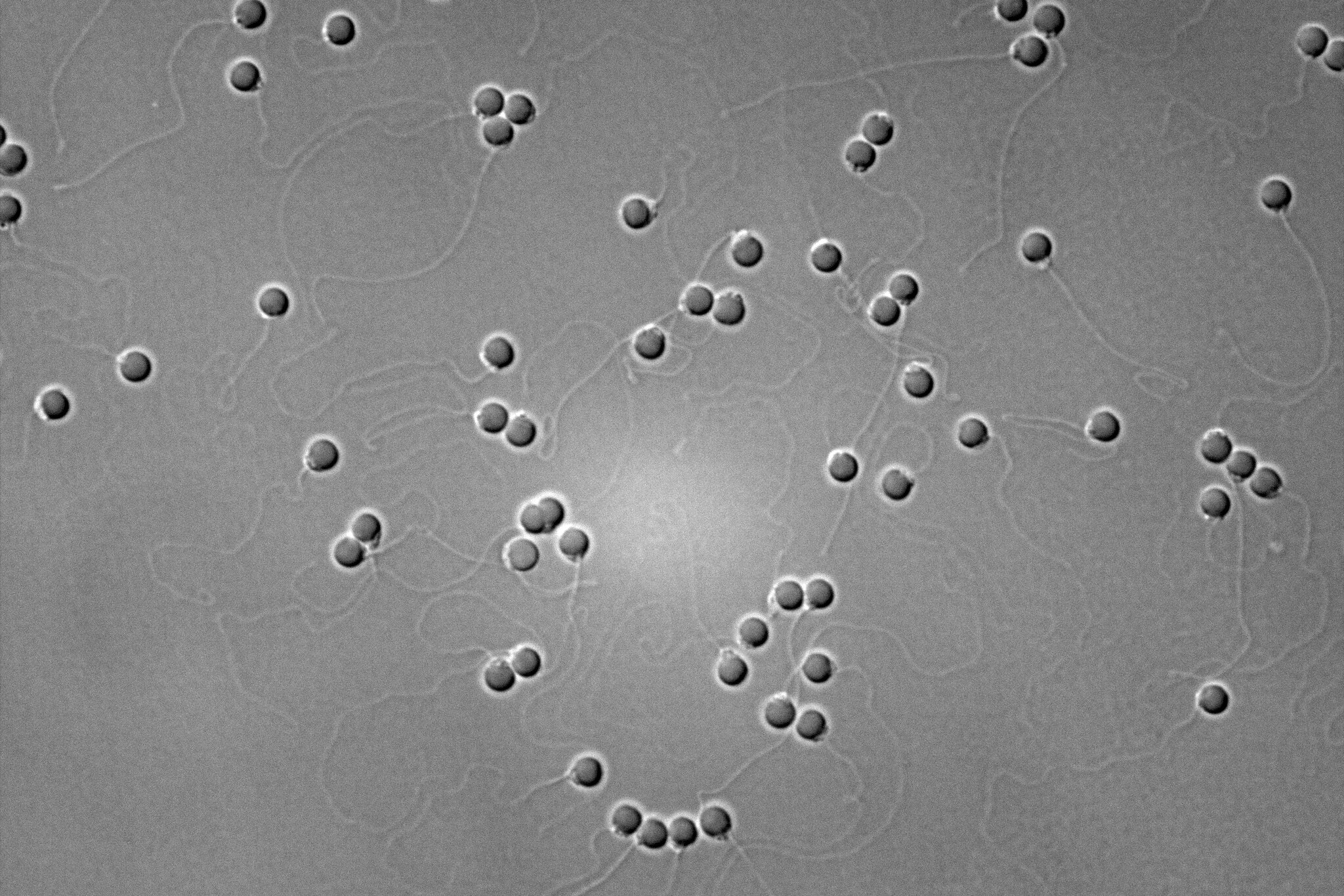 Dark grey circles with tails on a light gray background.